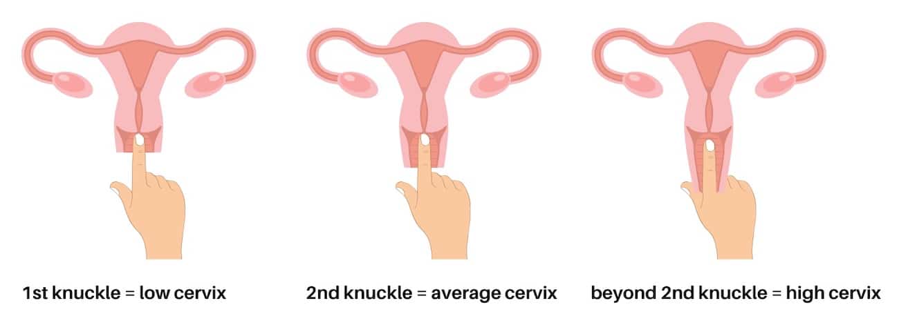 How To Check Cervix Position Mca Online 