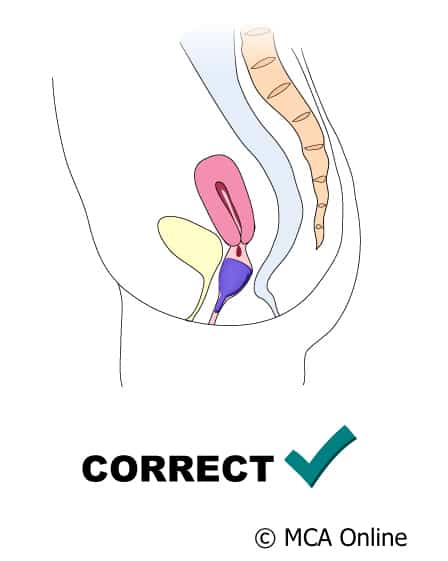 How to insert a menstrual cup